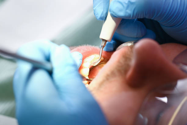 Best Knocked-Out Tooth Emergency  in Porters Neck, NC