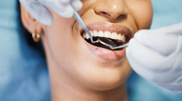 Best Chipped Tooth Repair Near Me  in Porters Neck, NC